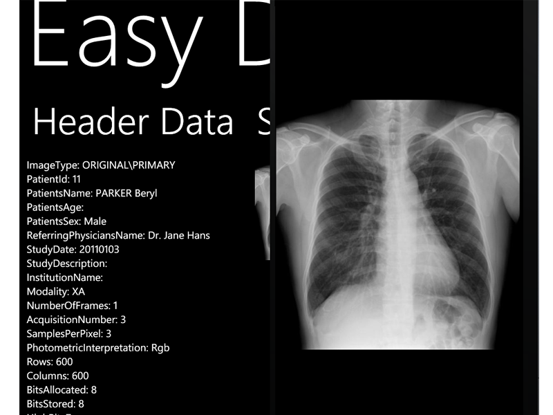 X-Ray Image on Windows Phone 7