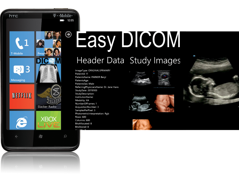 Easy DICOM Viewer for Windows Phone 7